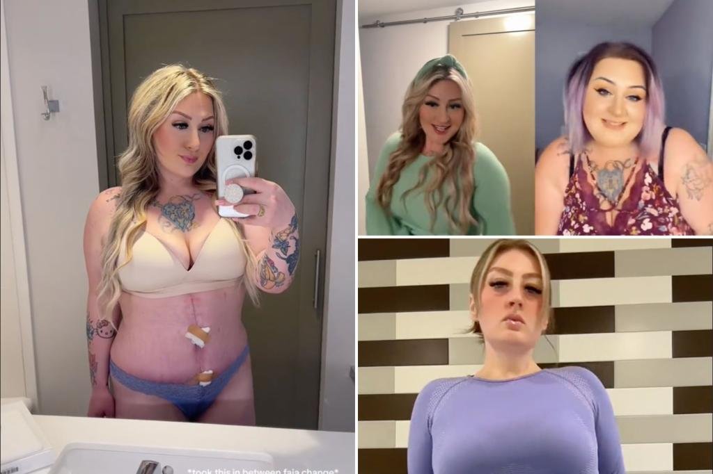 Weight loss patient says she "looked like a hot dog" after botched plastic surgery
